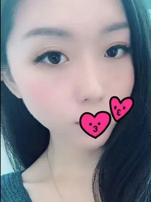 こゆき